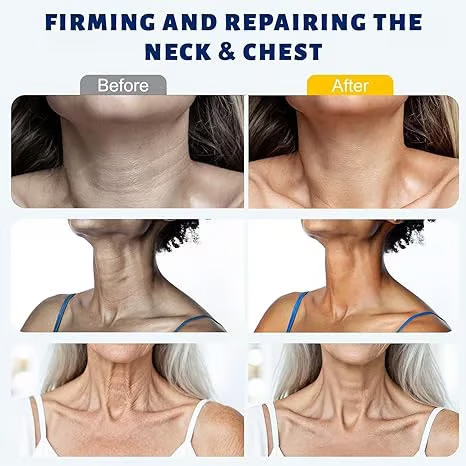 Roller Massage Neck Cream 🧴 Collagen & Hyaluronic Acid | Firms Neck, Reduces Wrinkles & Double Chin-eded