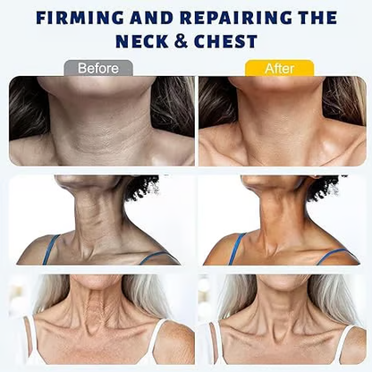 Roller Massage Neck Cream 🧴 Collagen & Hyaluronic Acid | Firms Neck, Reduces Wrinkles & Double Chin-eded