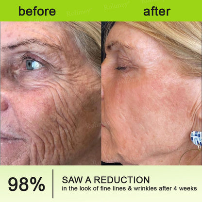 🔥Final 3 Hours: 70%OFF🔥 Botulinum & Vita-A Retinol Shot Wrinkle-Lift Tightening cream✨