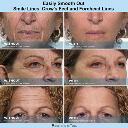 Tkhotpick™ Instant Face Temporary Tightener – Instant visible results in 30 seconds