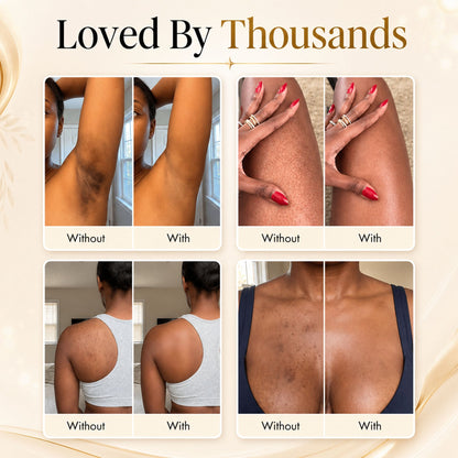 Tkhotpick™ Body Coverage Perfector Set