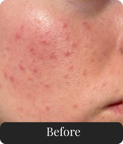 Before treatment