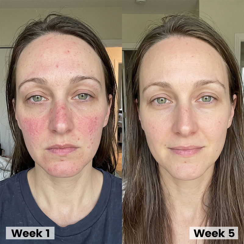 Jess skincare review