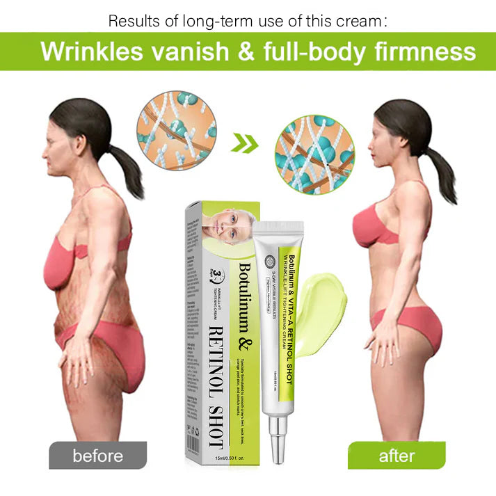 🔥Final 3 Hours: 70%OFF🔥 Botulinum & Vita-A Retinol Shot Wrinkle-Lift Tightening cream✨