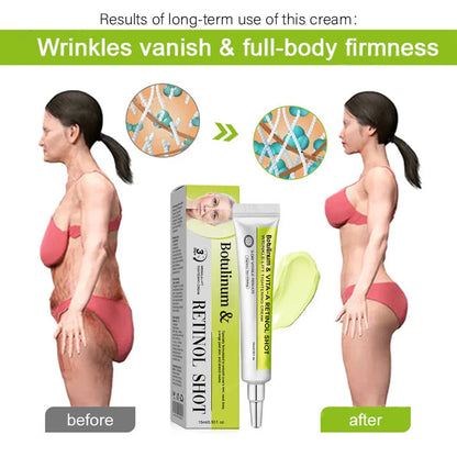 🔥Final 3 Hours: 70%OFF🔥 Botulinum & Vita-A Retinol Shot Wrinkle-Lift Tightening cream✨