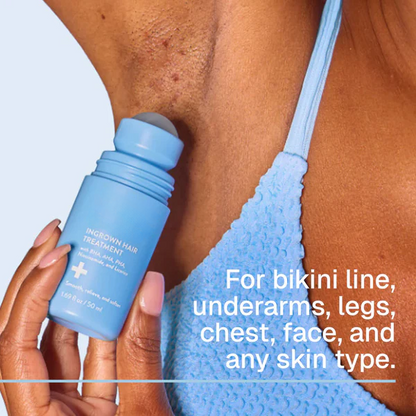 Tkhotpick: Smoothing Solution For Ingrown Hairs