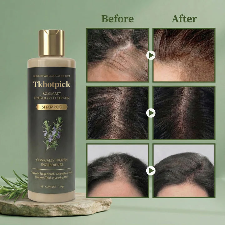 Tkhotpick™ Growth-Support Shampoo - 2-Pack