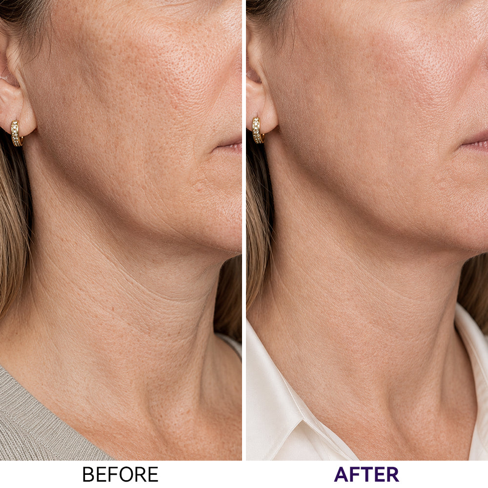 Collagen & PDRN Hydrogel Neck Patch（4Ea）