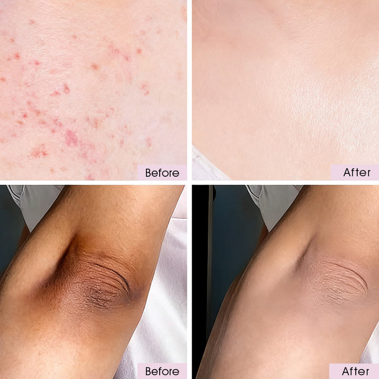 Before and after examples