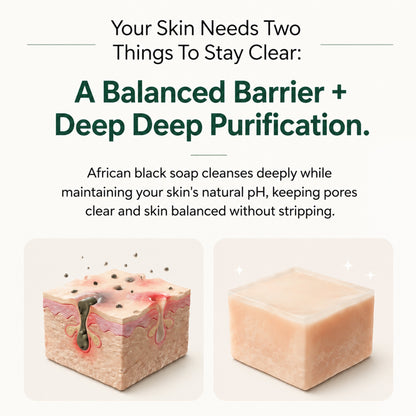 Pure Nilotica Shea Butter by Tkhotpick™