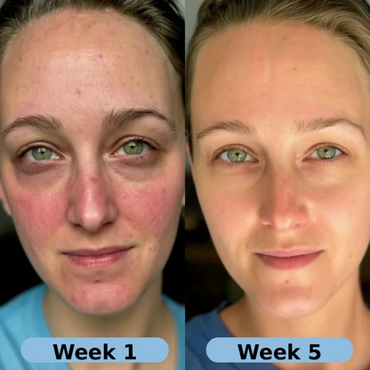 Korean Collagen Serum for Mature Skin
