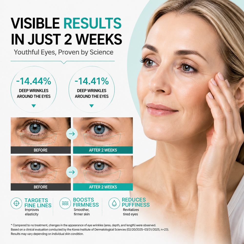 PDRN Eye Cream Two Week Results