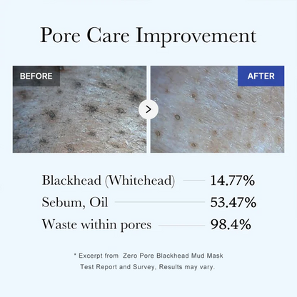 Zero Pore Blackhead Mud Mask-Free Pore Brush