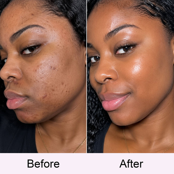 Customer before and after
