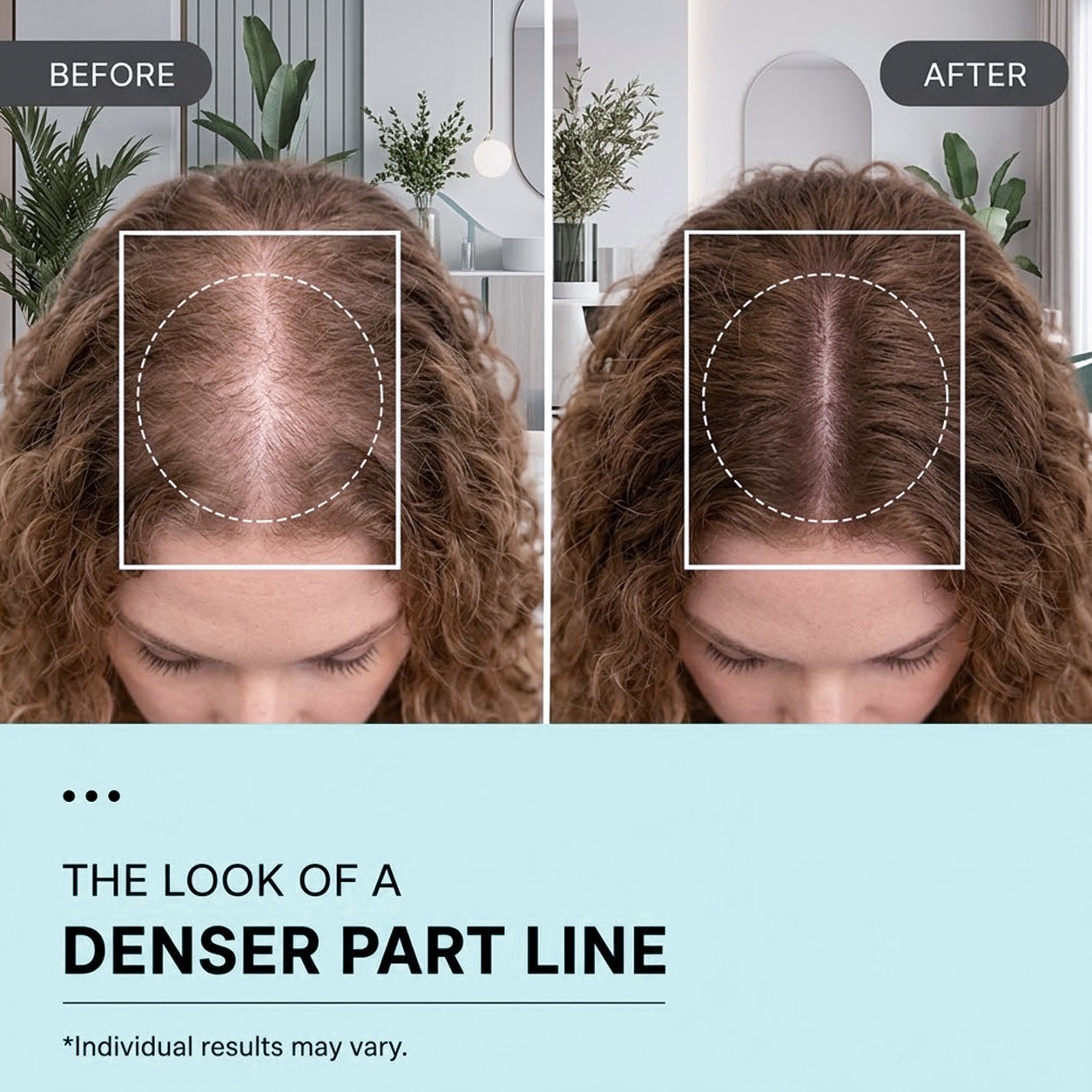 PDRN Shed-Control Serum
