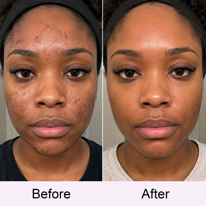 Customer before and after