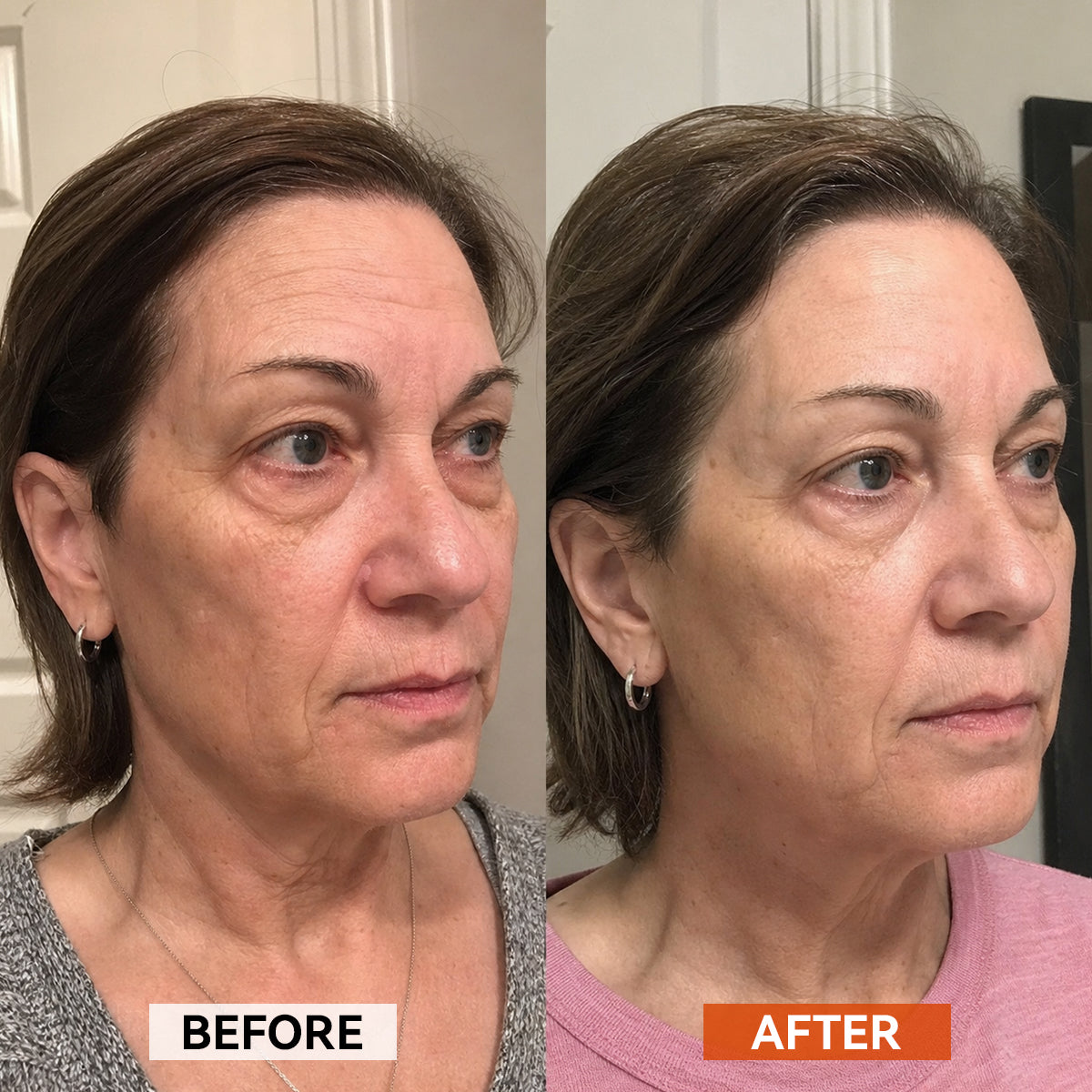 Korean PDRN & Peptide-8 Glass Skin Serum