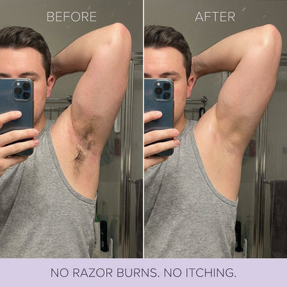 Tkhotpick Hair Removal Mousse