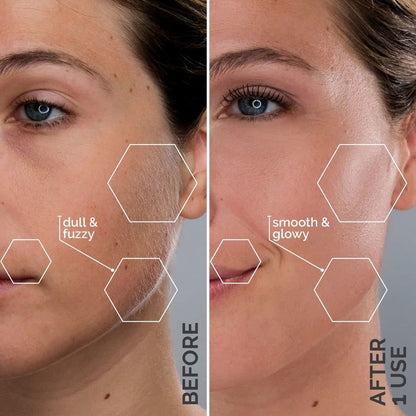 Sonic Dermaplaning Pro+