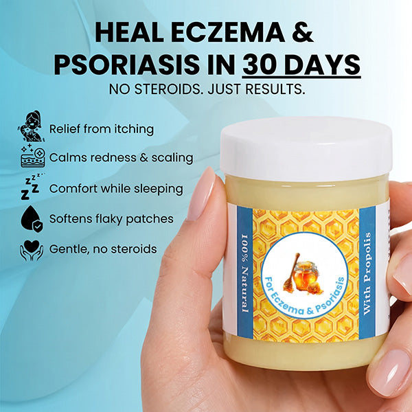 Repair Balm For Eczema & Psoriasis