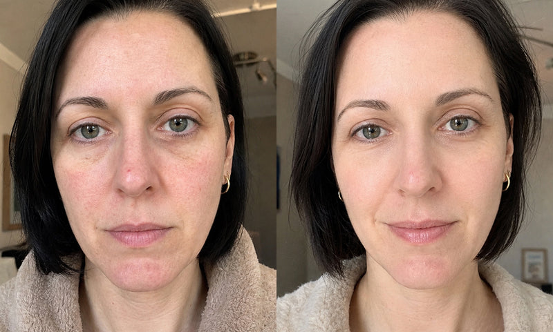 Mara skincare review