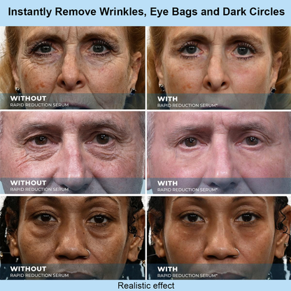 Tkhotpick™ Instant Face Temporary Tightener – Instant visible results in 30 seconds