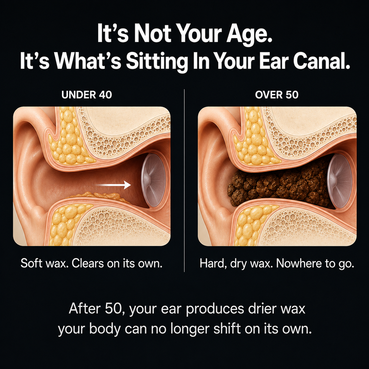 🥳 2026 HOT SALE 🥳 💞 50K+ SOLD! 🌿 50% OFF! Reusable Earwax Remover – Soft, Gentle & Mess-Free. Easy to Use, Perfect for Seniors. 💚