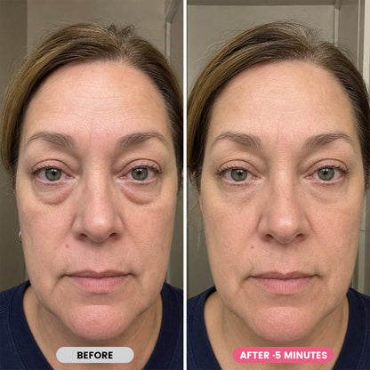 K-Lift™ Instant Lift Serum | PDRN + Peptides — image 4
